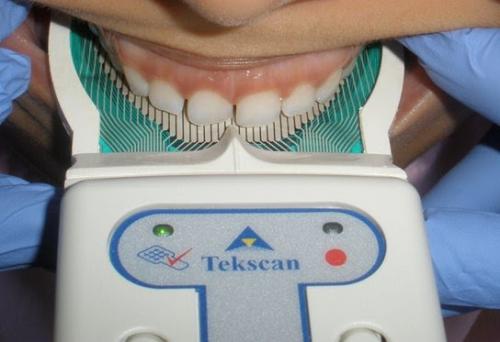 9.TekScan  In Mouth-min